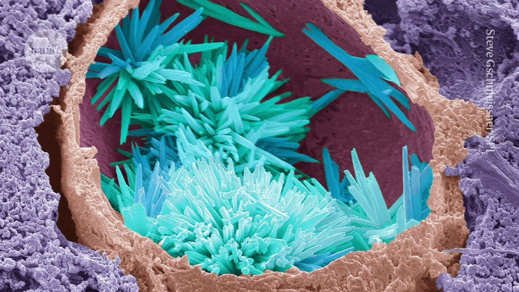 CRISPR, Regulation, and the Real Economics: Gene-Editing Therapies Face a New FDA in 2025-2026