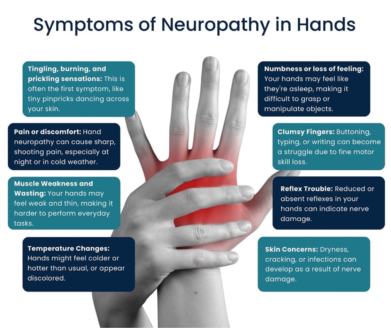 Hand with symptoms of carpal tunnel syndrome and focal neuropathy