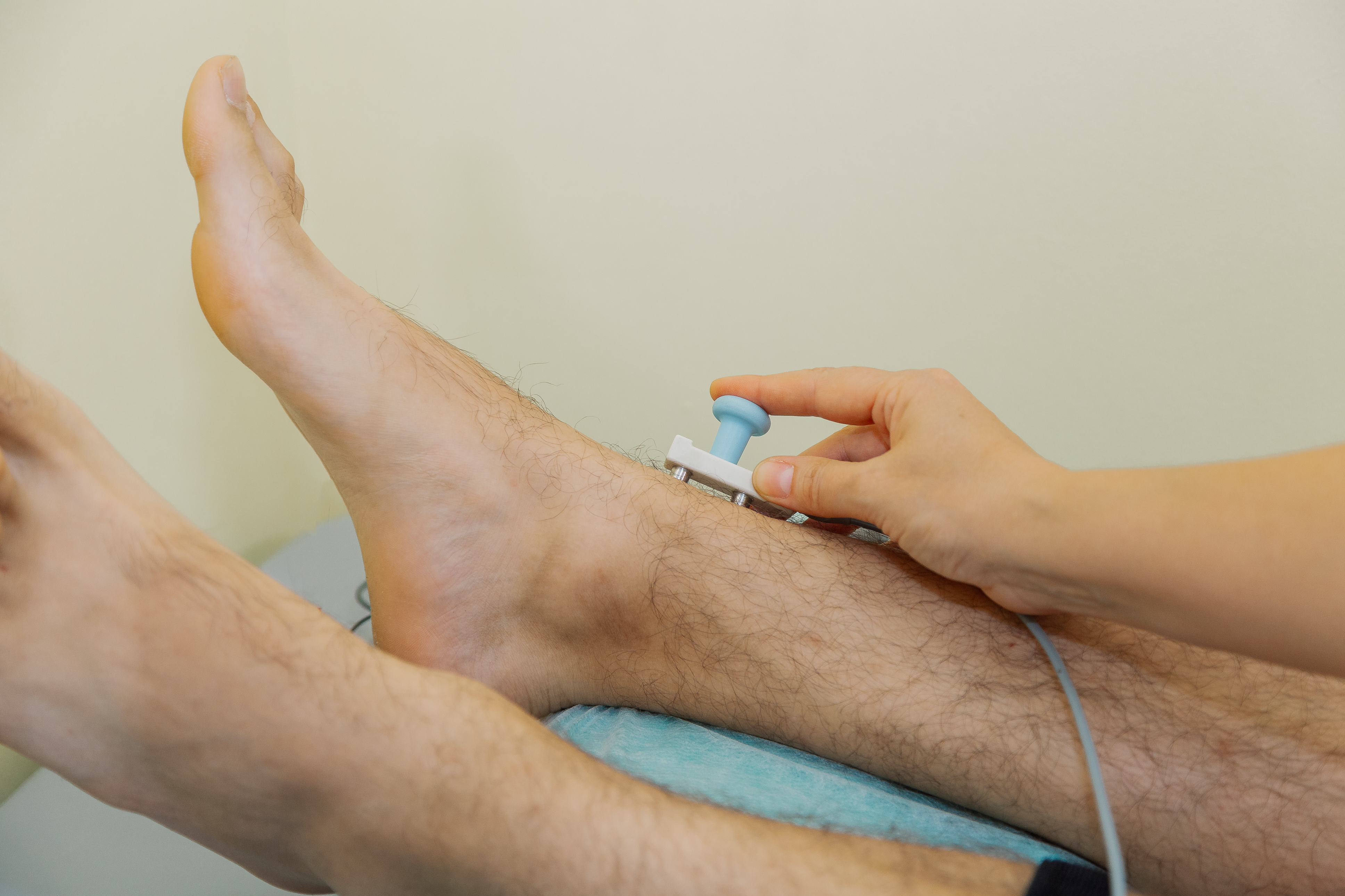 Nerve conduction test for neuropathy diagnosis