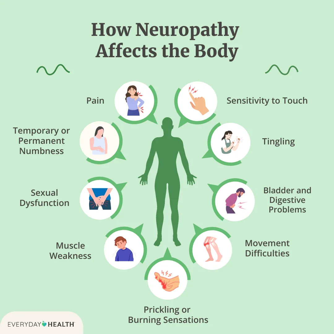 Diagram showing how neuropathy affects the body's peripheral nervous system